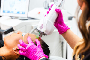 An Erasable Med Spa provider focuses laser rejuvenation with HALO on a patient's forehead as one step of skin toning in Tampa. 